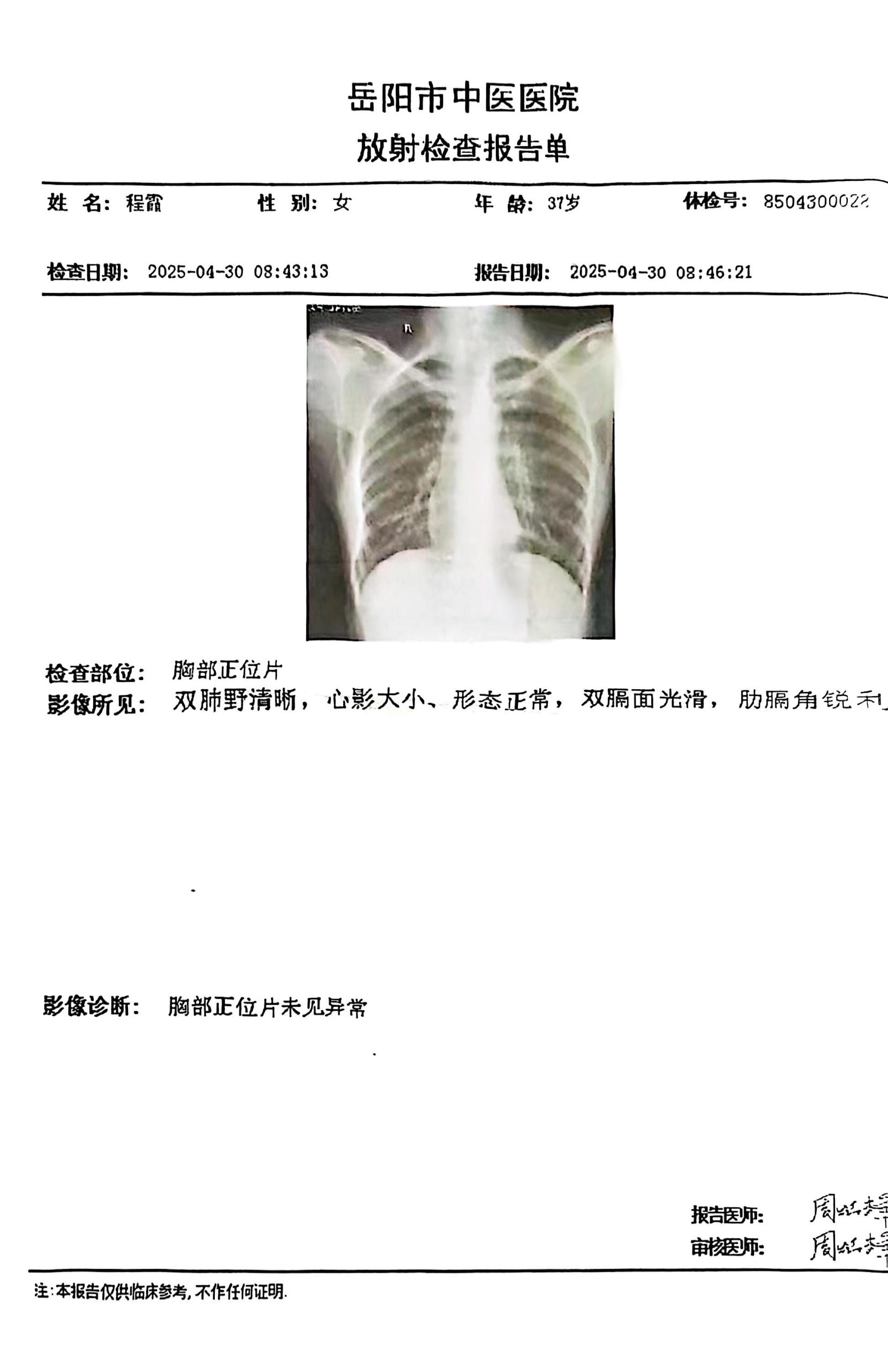 獲得其他 獲得其他